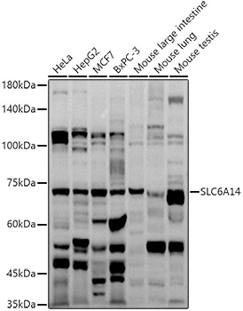 SLC6A14 Rabbit Polyclonal Antibody