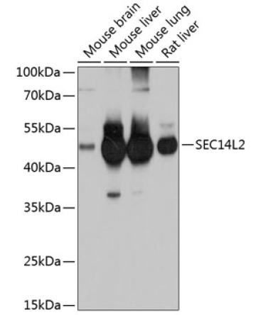 SEC14L2 Rabbit Polyclonal Antibody