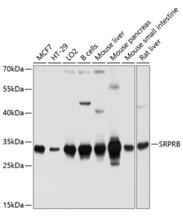 SRPRB Rabbit Polyclonal Antibody