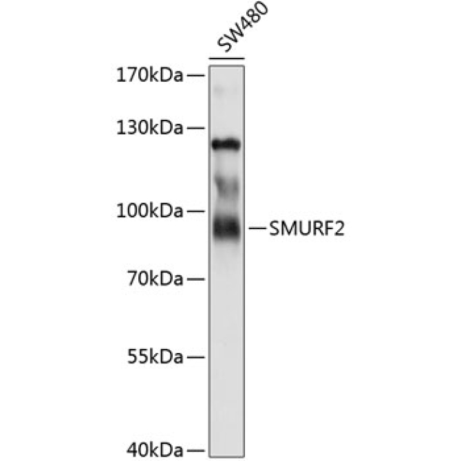 SMURF2 Rabbit Polyclonal Antibody