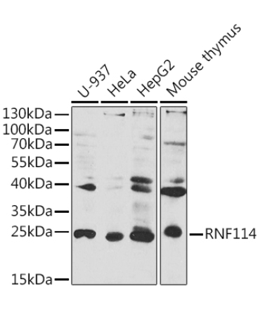 RNF114 Rabbit Polyclonal Antibody