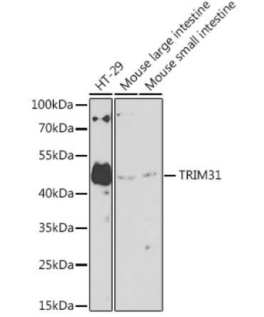 TRIM31 Rabbit Polyclonal Antibody