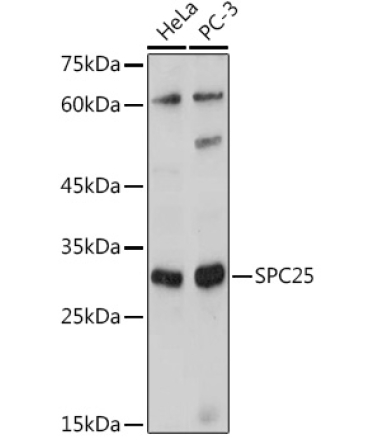SPC25 Rabbit Polyclonal Antibody