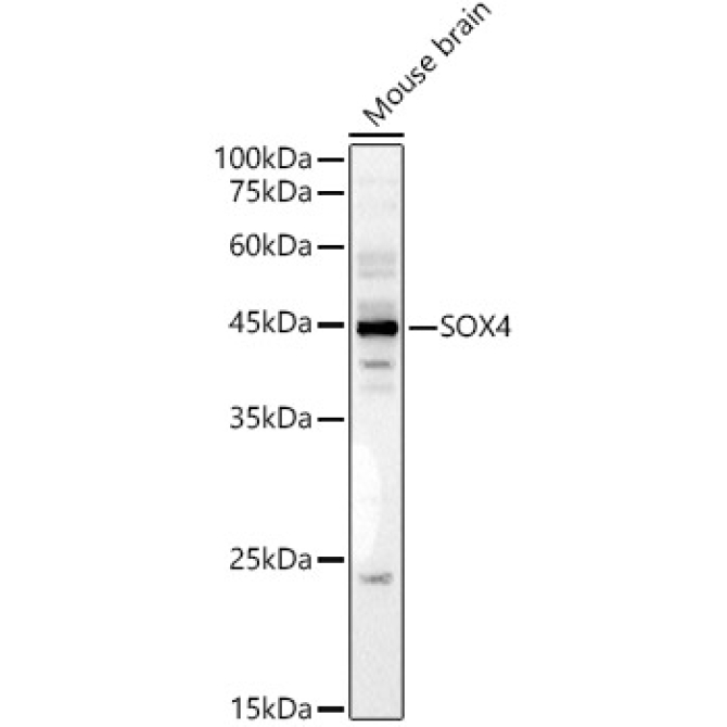 SOX4 Rabbit Polyclonal Antibody