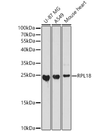 RPL18 Rabbit Polyclonal Antibody