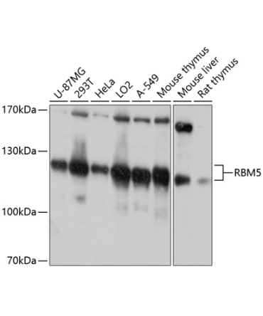 RBM5 Rabbit Polyclonal Antibody