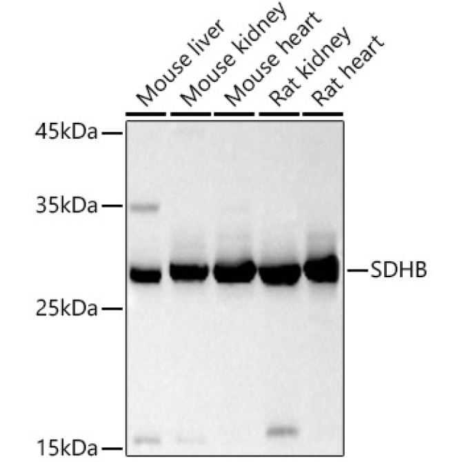 SDHB Rabbit Polyclonal Antibody