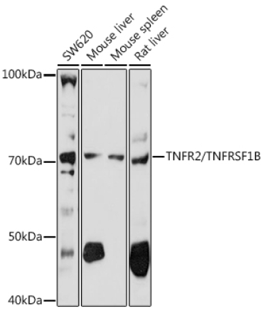 TNFR2/TNFRSF1B Rabbit Polyclonal Antibody