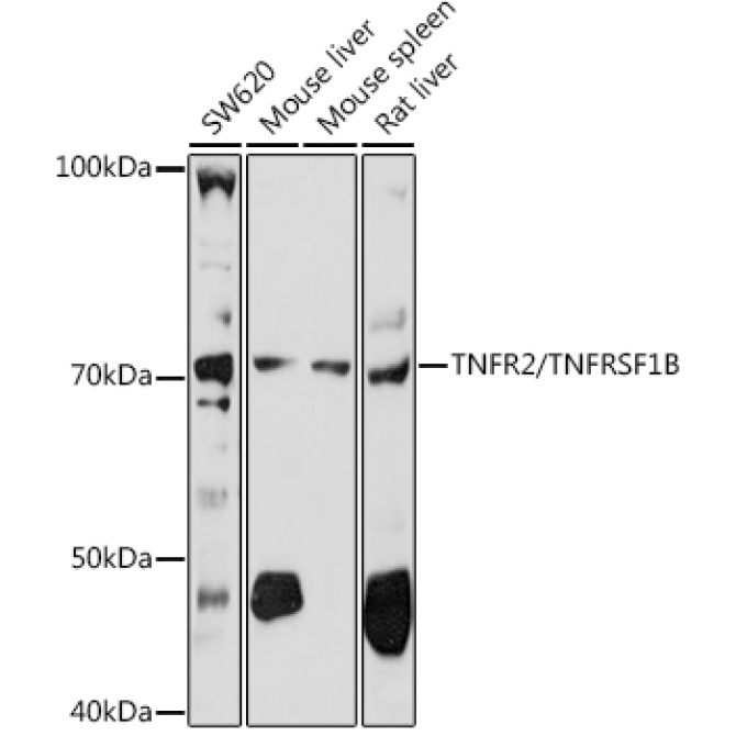 TNFR2/TNFRSF1B Rabbit Polyclonal Antibody