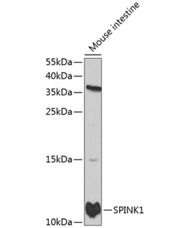 SPINK1 Rabbit Polyclonal Antibody