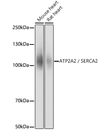 SERCA2/ATP2A2 Rabbit Polyclonal Antibody
