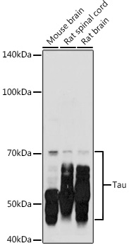 Tau Rabbit Polyclonal Antibody