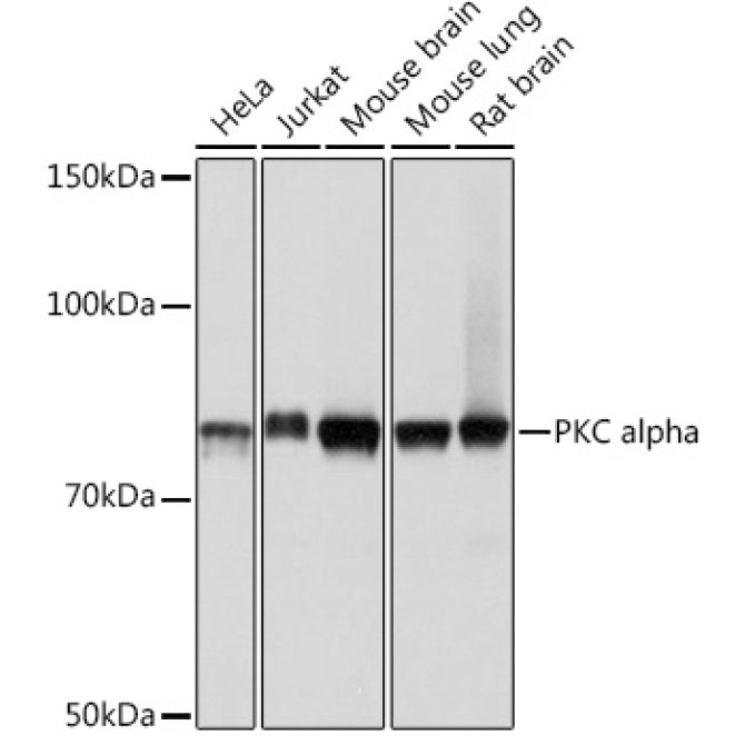 PKC alpha Rabbit Monoclonal Antibody