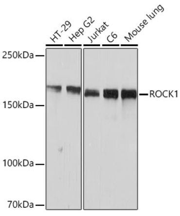 ROCK1 Rabbit Monoclonal Antibody