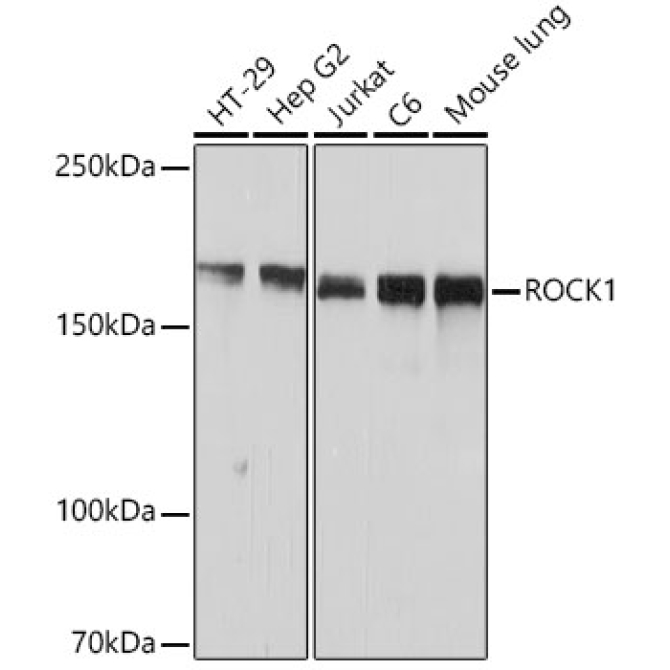 ROCK1 Rabbit Monoclonal Antibody