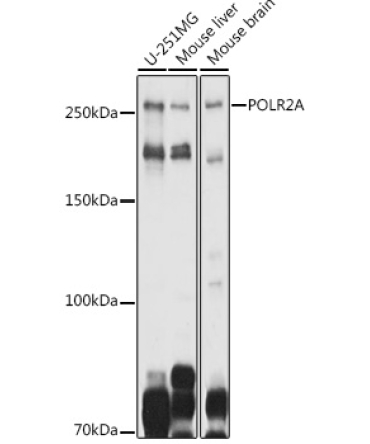 POLR2A Rabbit Polyclonal Antibody
