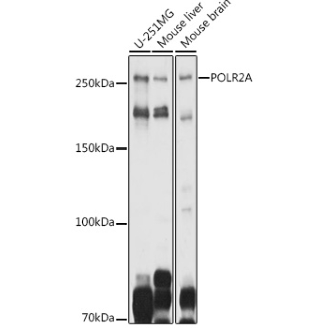 POLR2A Rabbit Polyclonal Antibody