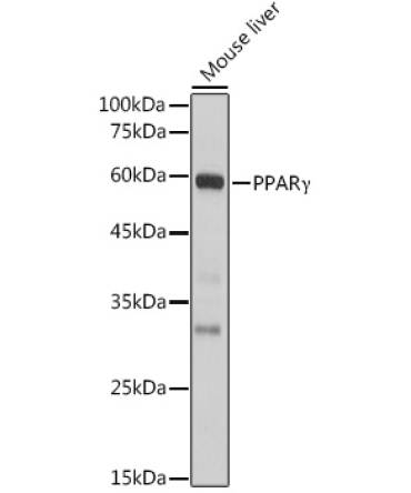 PPARGamma Rabbit Polyclonal Antibody