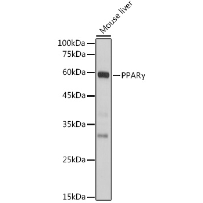 PPARGamma Rabbit Polyclonal Antibody