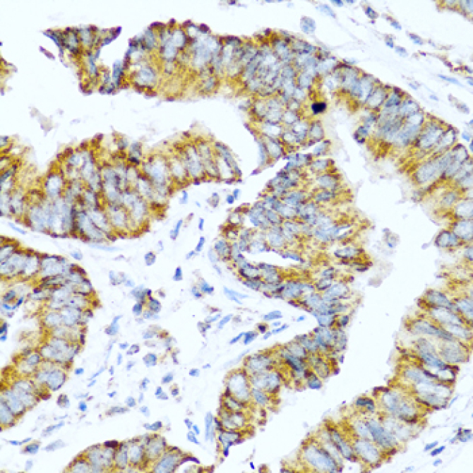 Pro-glucagon Rabbit Polyclonal Antibody