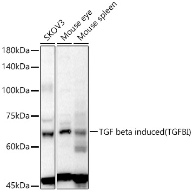 TGF beta induced (TGFBI) Rabbit Polyclonal Antibody