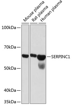 SERPINC1 Rabbit Monoclonal Antibody