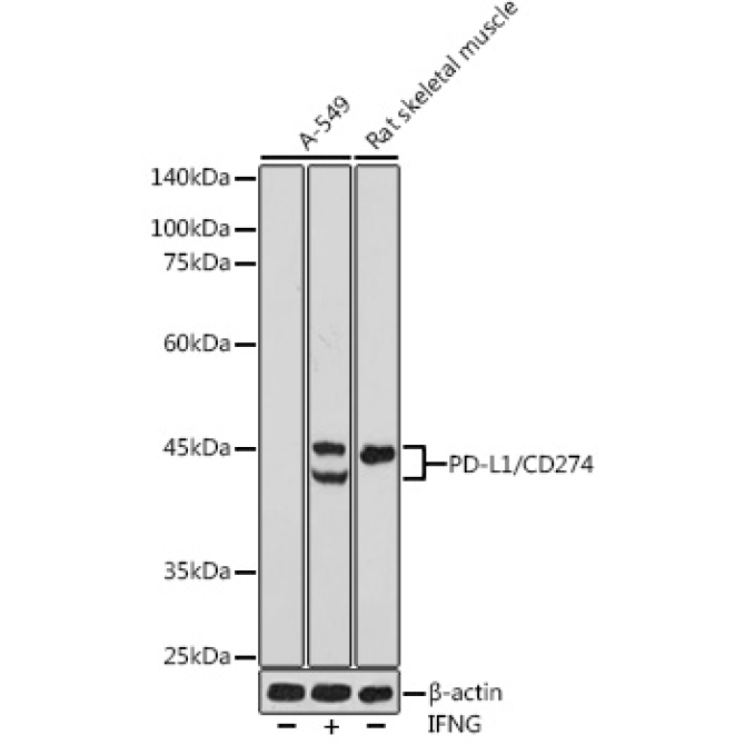 PD-L1/CD274 Rabbit Polyclonal Antibody