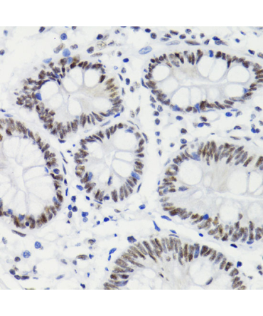 Phospho-Bcl-2-T56 Rabbit Polyclonal Antibody