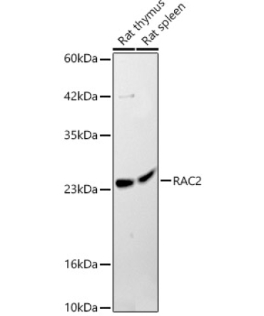 RAC2 Rabbit Polyclonal Antibody