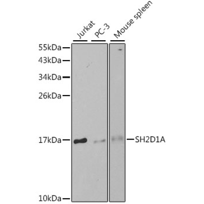 SH2D1A Rabbit Polyclonal Antibody