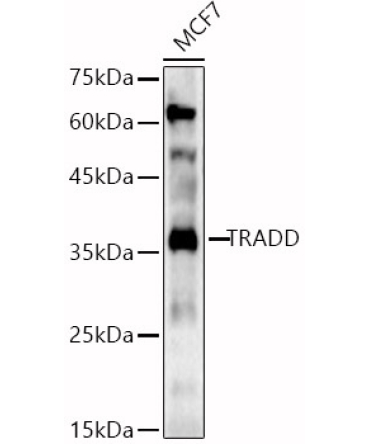 TRADD Rabbit Polyclonal Antibody