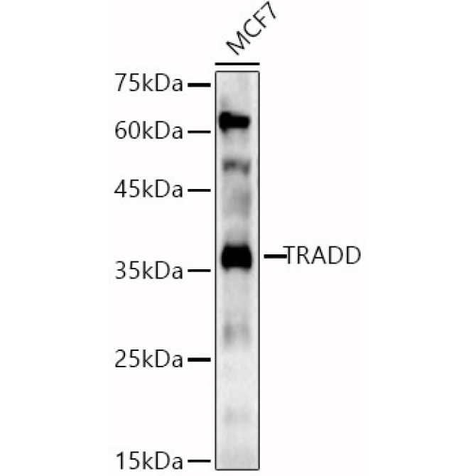 TRADD Rabbit Polyclonal Antibody