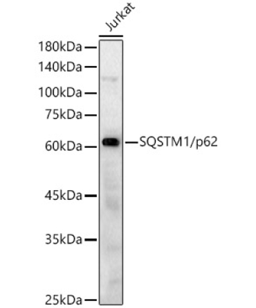 SQSTM1/p62 Rabbit Polyclonal Antibody