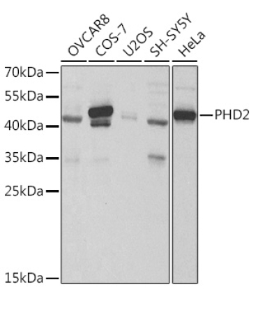 PHD2/EGLN1 Rabbit Polyclonal Antibody