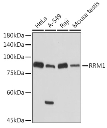 RRM1 Rabbit Polyclonal Antibody