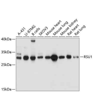 RSU1 Rabbit Polyclonal Antibody