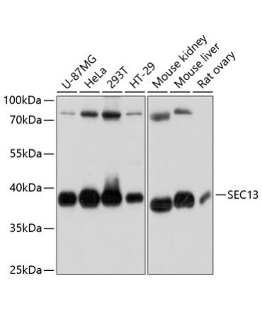 SEC13 Rabbit Polyclonal Antibody