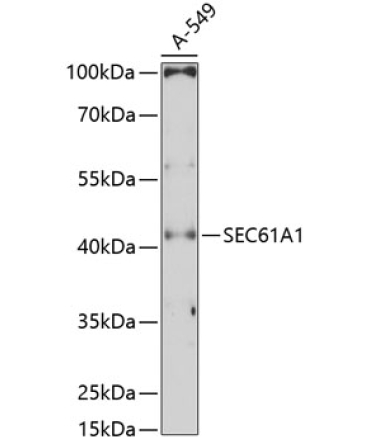 SEC61A1 Rabbit Polyclonal Antibody