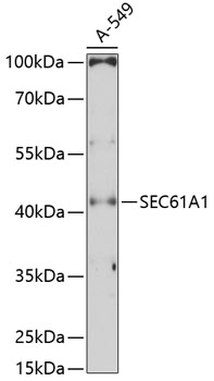 SEC61A1 Rabbit Polyclonal Antibody
