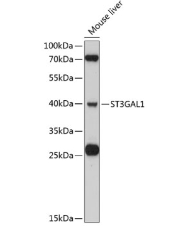 ST3GAL1 Rabbit Polyclonal Antibody