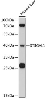 ST3GAL1 Rabbit Polyclonal Antibody