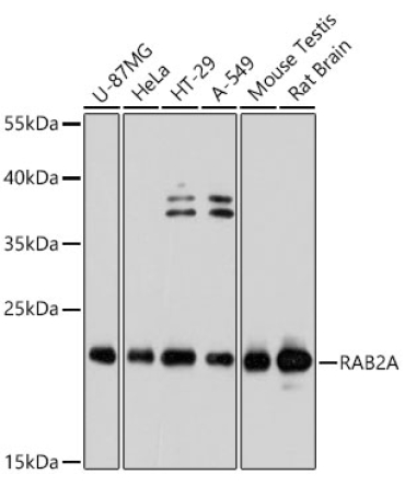 RAB2A Rabbit Polyclonal Antibody