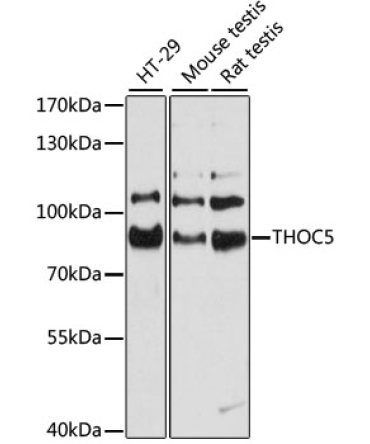 THOC5 Rabbit Polyclonal Antibody