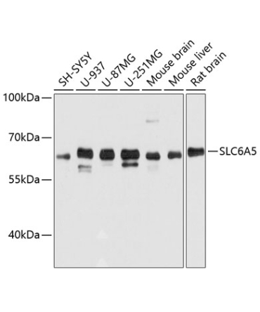 SLC6A5 Rabbit Polyclonal Antibody
