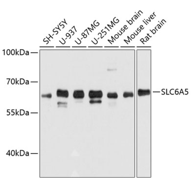 SLC6A5 Rabbit Polyclonal Antibody