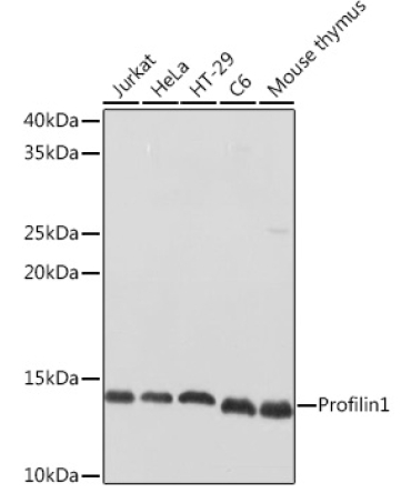 Profilin1 Rabbit Polyclonal Antibody