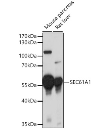 SEC61A1 Rabbit Polyclonal Antibody