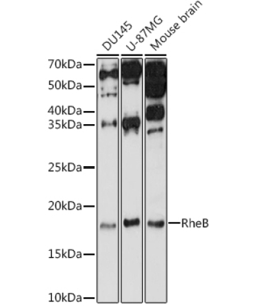 RheB Rabbit Polyclonal Antibody
