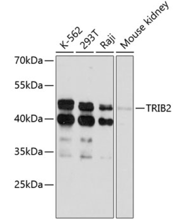 TRIB2 Rabbit Polyclonal Antibody