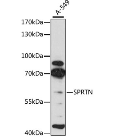 SPRTN Rabbit Polyclonal Antibody